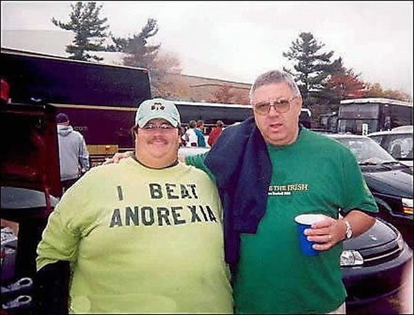 People with Double Chin (16 pics)