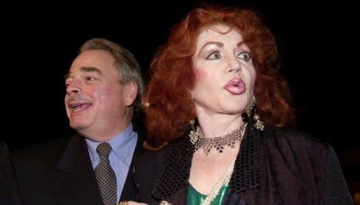 Stallone's mom, Jackie, after Zillions of Plastic Ops (29 pics)