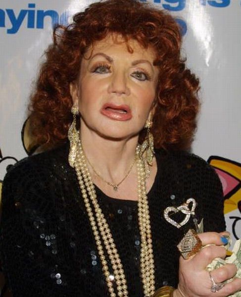 Stallone's mom, Jackie, after Zillions of Plastic Ops (29 pics)