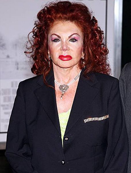 Stallone's mom, Jackie, after Zillions of Plastic Ops (29 pics)
