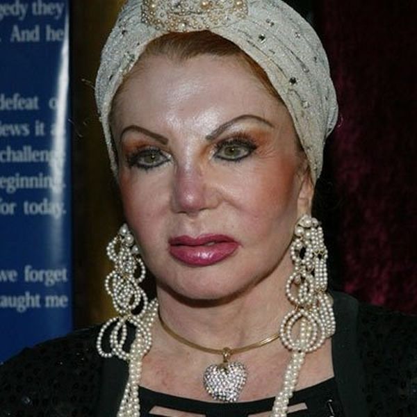 Stallone's mom, Jackie, after Zillions of Plastic Ops (29 pics)