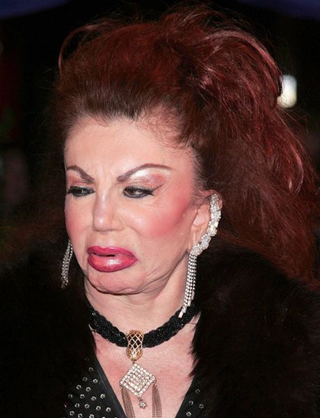 Stallone's mom, Jackie, after Zillions of Plastic Ops (29 pics)