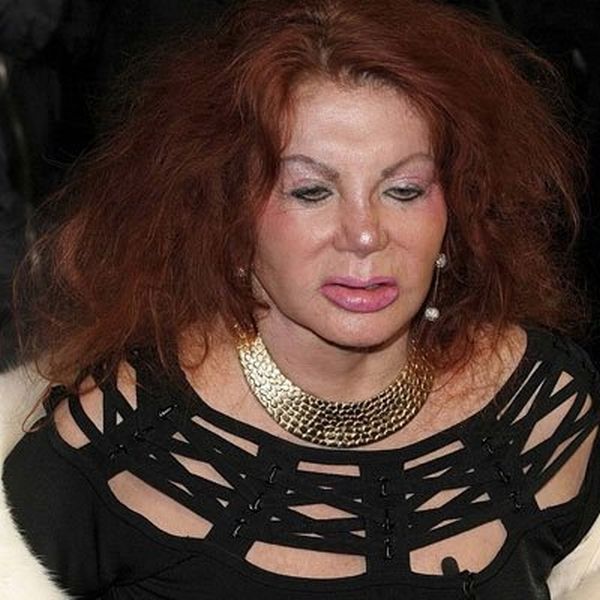 Stallone's mom, Jackie, after Zillions of Plastic Ops (29 pics)