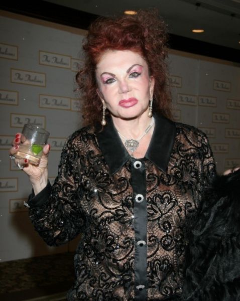 Stallone's mom, Jackie, after Zillions of Plastic Ops (29 pics)