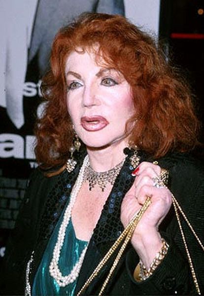 Stallone's mom, Jackie, after Zillions of Plastic Ops (29 pics)