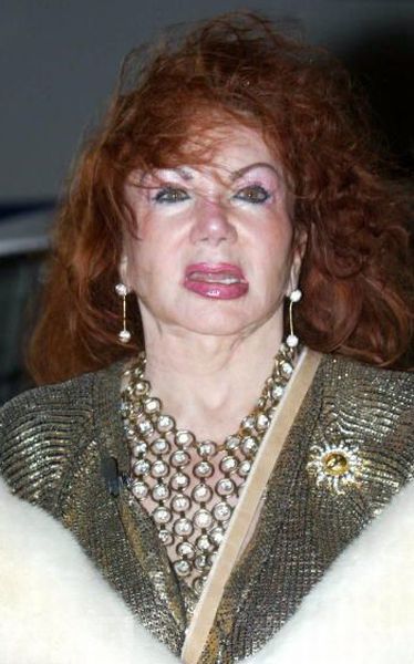 Stallone's mom, Jackie, after Zillions of Plastic Ops (29 pics)