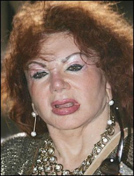 Stallone's mom, Jackie, after Zillions of Plastic Ops (29 pics)