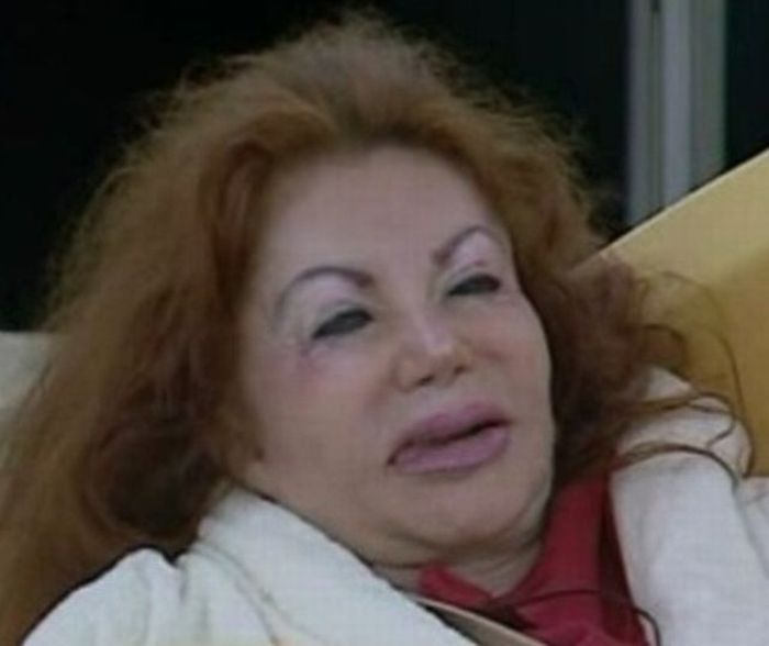 Stallone's mom, Jackie, after Zillions of Plastic Ops (29 pics)
