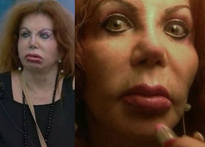 Stallone's mom, Jackie, after Zillions of Plastic Ops (29 pics)