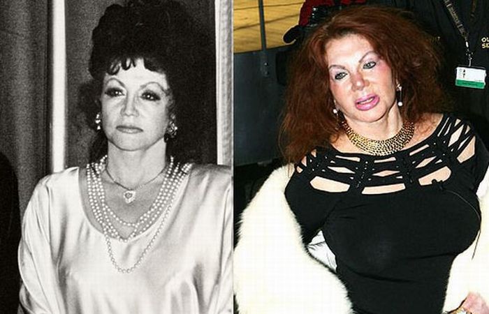 Stallone's mom, Jackie, after Zillions of Plastic Ops (29 pics)