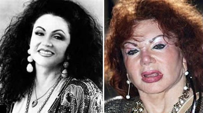 Stallone's mom, Jackie, after Zillions of Plastic Ops (29 pics)