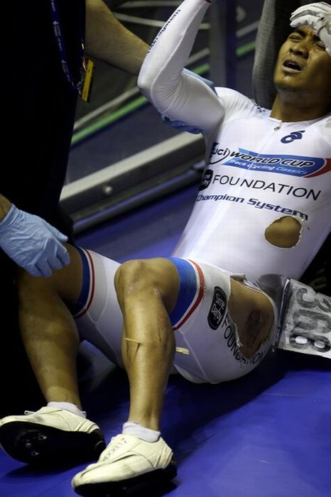 Azizulhasni Awang Finishes Track Race with Splinter Through Leg (10 pics + video)