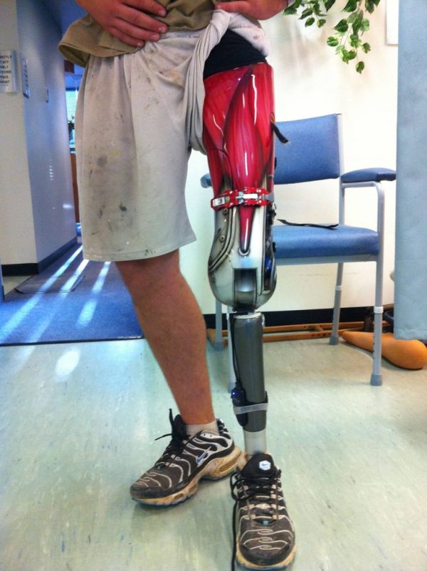 Awesome Prosthetic Leg (7 pics)