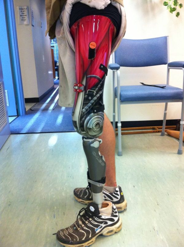 Awesome Prosthetic Leg (7 pics)