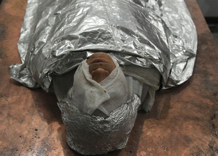 Tobacco Cure From Cancer (4 pics)
