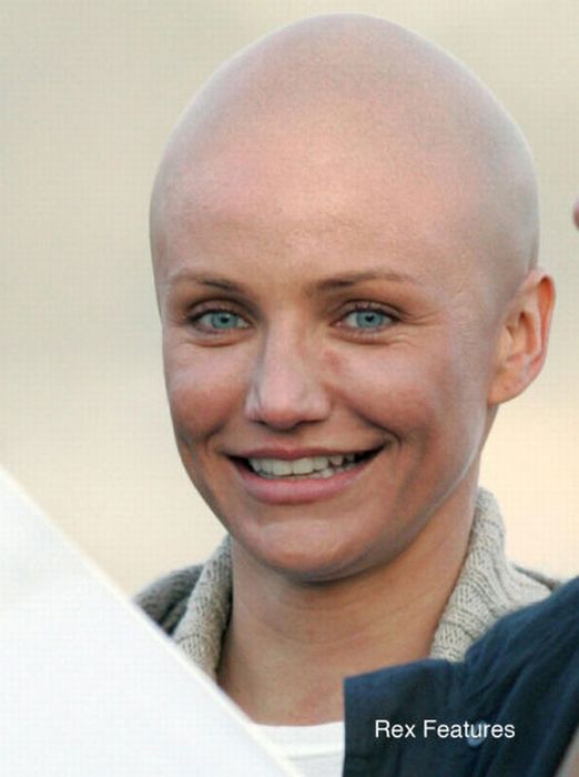 Bald Celebrities (20 pics) Bald Celebrities (20 pics)