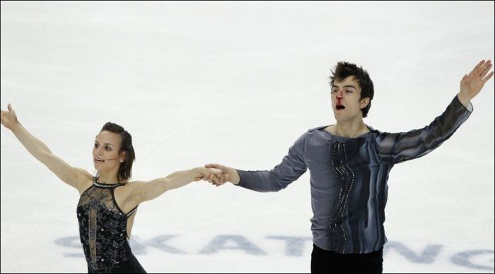 Accident at the Figure Skating Competition in Moscow (5 pics)