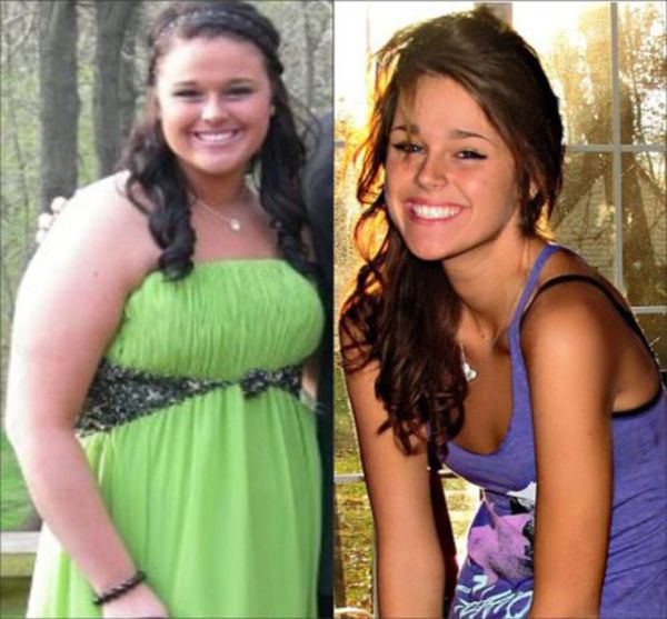 Extreme Weight Loss (10 pics)