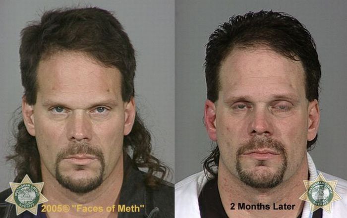 Faces of Meth. Part 2 (38 pics)