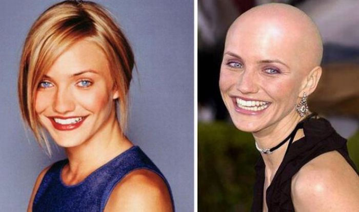Celebrities Who Lost Their Hair (31 pics)