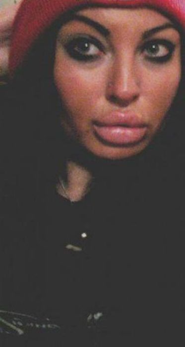 Pretty Girl with Ugly Silicone Lips (25 pics)