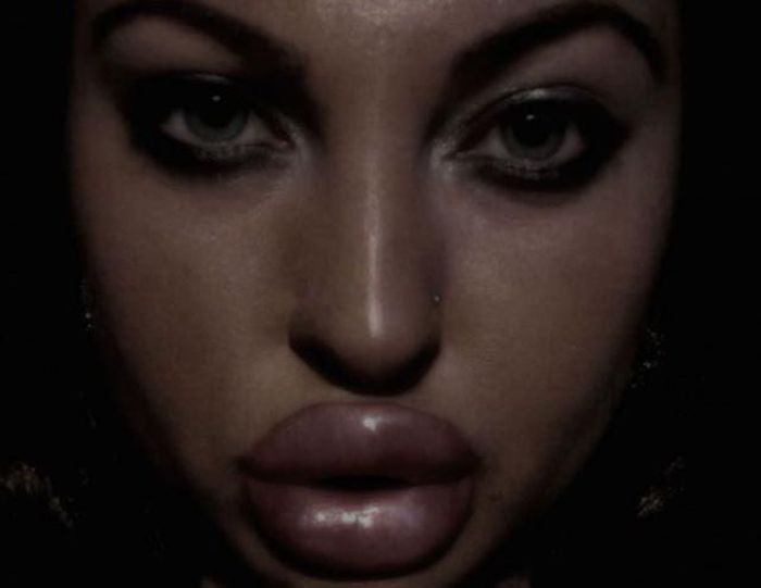 Pretty Girl with Ugly Silicone Lips (25 pics)