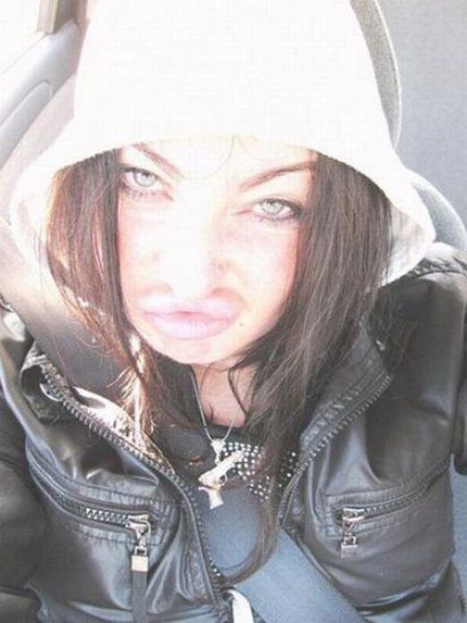 Pretty Girl with Ugly Silicone Lips (25 pics)