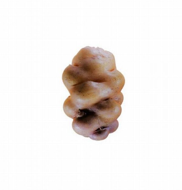 Different Types of Potato (18 pics)