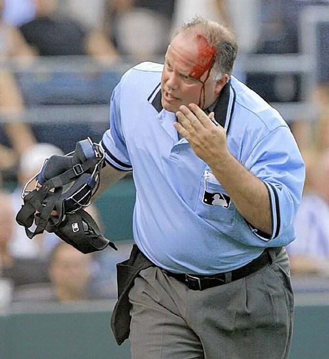 Baseball Hurts (21 pics)