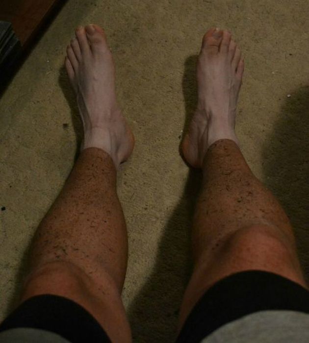 Acid Picdump (92 pics)