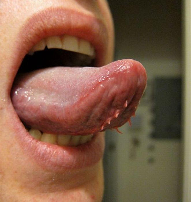 Acid Picdump (97 pics)