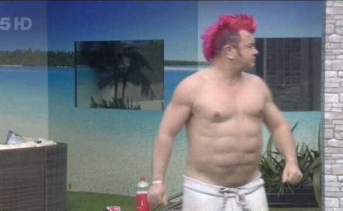 The Worst Abdominal Implants (2 pics)