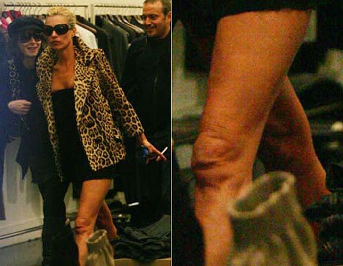 Bad Moments for Famous Celebrities (44 pics)