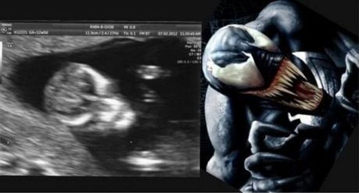 Babies in Ultrasound Looking Like Fictional Characters (3 pics)