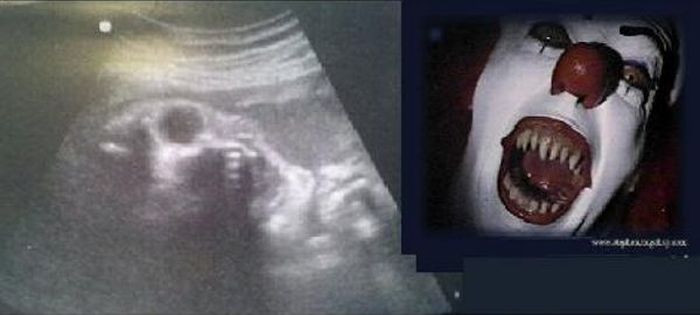 Babies in Ultrasound Looking Like Fictional Characters (3 pics)
