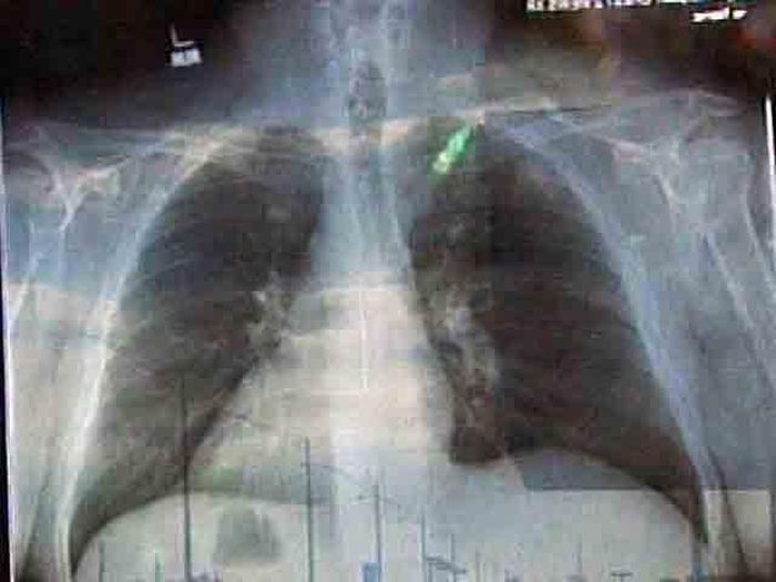 Apparitions of Jesus. Part 2 (26 pics)