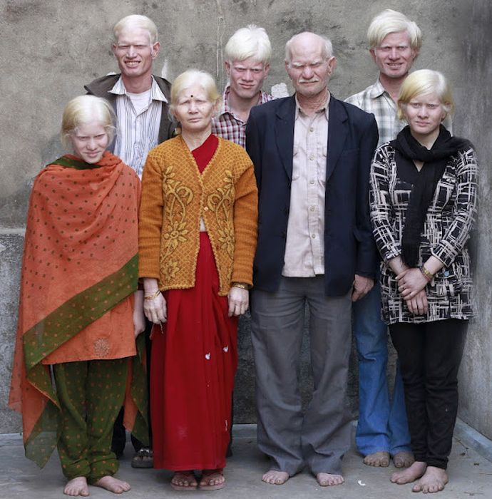 World's Biggest Albino Family (17 pics)