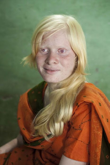 World's Biggest Albino Family (17 pics)