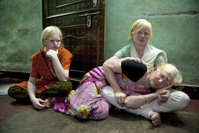 World's Biggest Albino Family (17 pics)