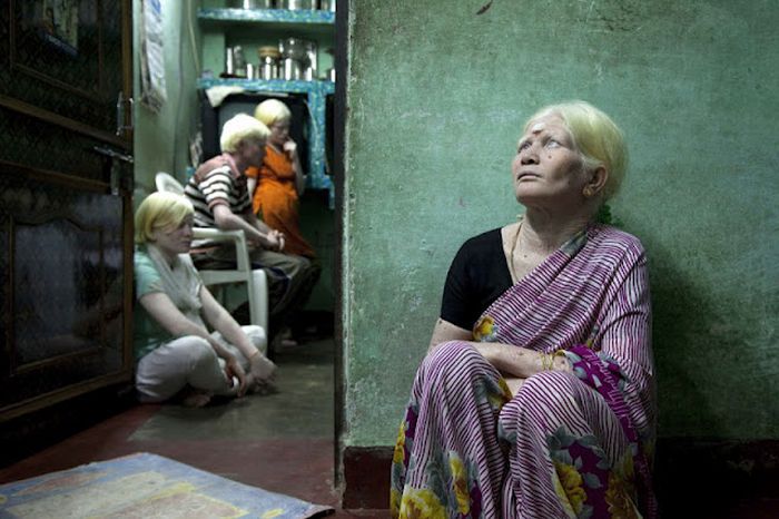 World's Biggest Albino Family (17 pics)