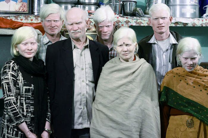 World's Biggest Albino Family (17 pics)