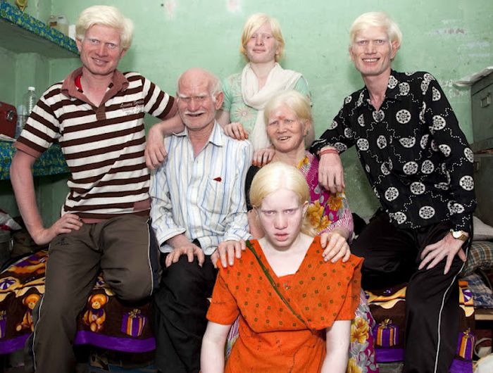 World's Biggest Albino Family (17 pics)