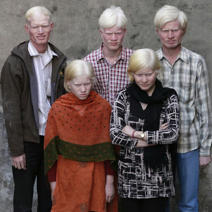 World's Biggest Albino Family (17 pics)