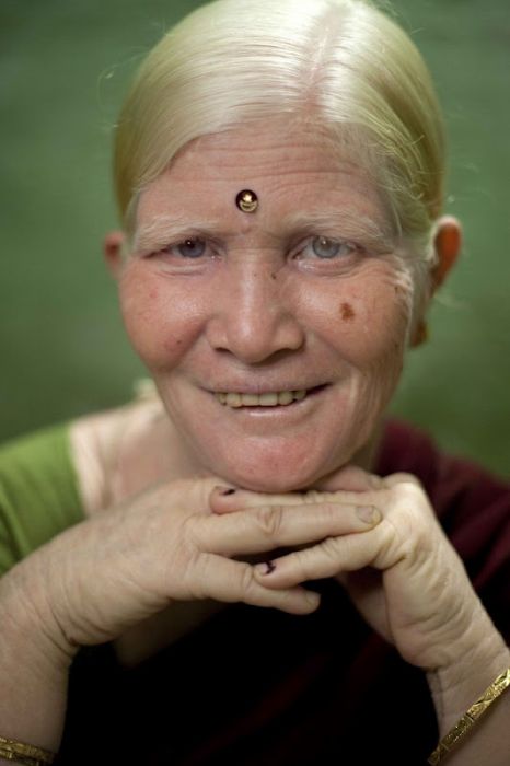 World's Biggest Albino Family (17 pics)