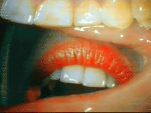 Acid Gifdump (10 gifs)
