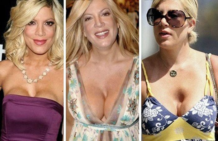 Celebs with Fake Breasts (14 pics)