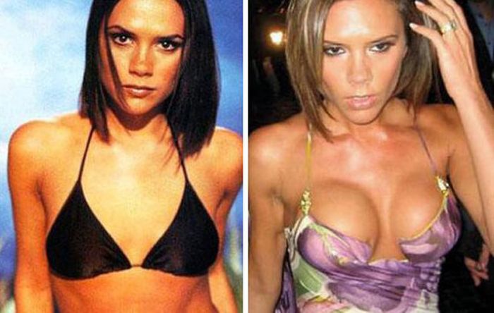 Celebs with Fake Breasts (14 pics)