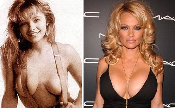 Celebs with Fake Breasts (14 pics)