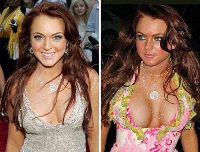 Celebs with Fake Breasts (14 pics)