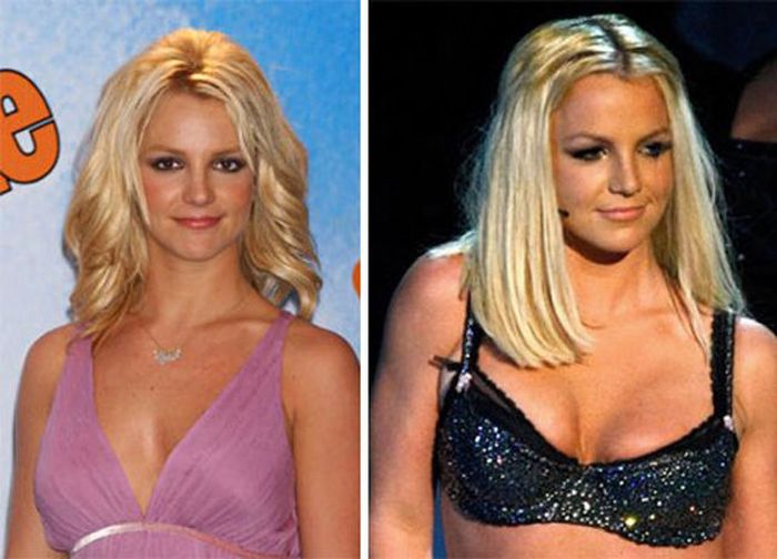 Celebs with Fake Breasts (14 pics)